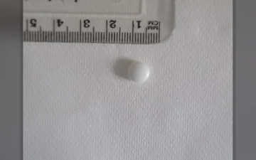 Bensedin-Tabletten