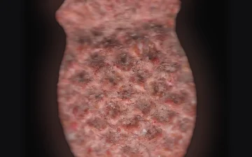 Pina-Tabletten (Ecstasy / MDMA)