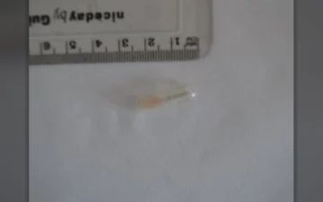 Galenika Rivotril-Tabletten (Clonazepam)