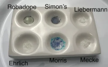 Alpha-PVP, MDPV und NEP: die Cathinone, die kein MMC sind