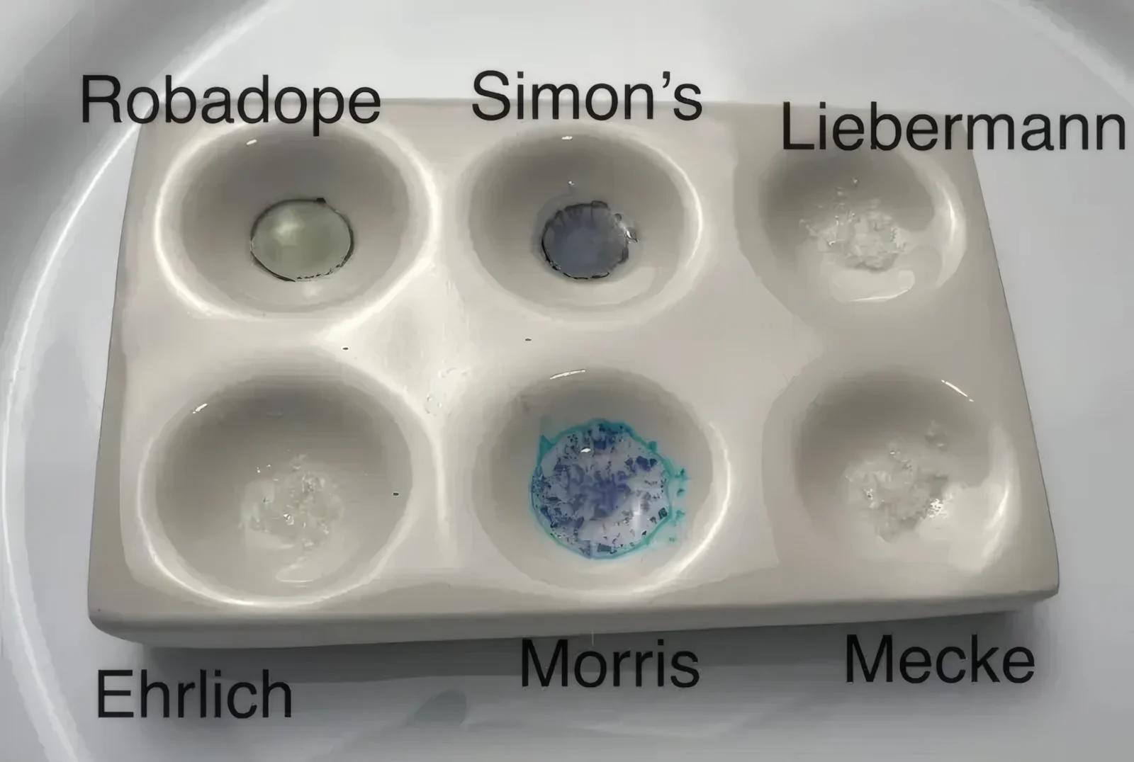 Alpha-PVP, MDPV und NEP: die Cathinone, die kein MMC sind