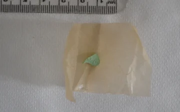 Kleines grünes Pillenstück auf Papier neben einem Lineal