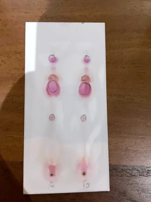 Eine entwickelte Cannabinoid-Testkarte auf einem Holztisch mit zwei Probenbahnen, mit A und B beschriftet, jede mit einer Reihe rosa und roter Flecken, mit Bleistift umkreist